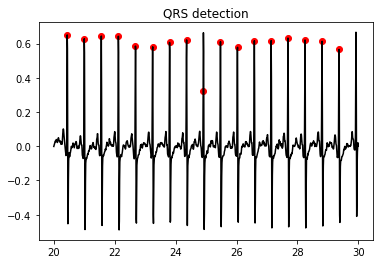 ../../_images/qrs-detection_13_1.png