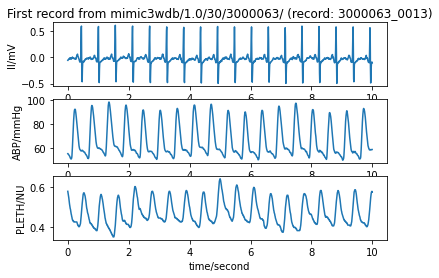 ../../_images/qrs-detection_3_1.png