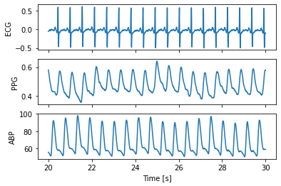 ../../_images/qrs-detection_5_2.png