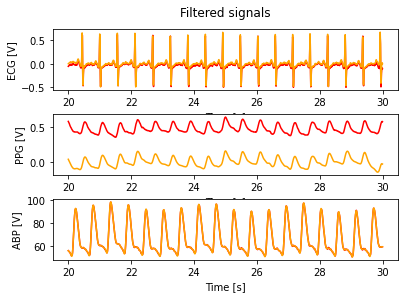 ../../_images/qrs-detection_8_0.png