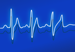Completing a BHF Immediate Postdoctoral Research Fellowship