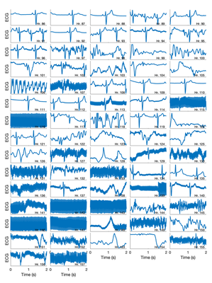**ECG signals during the second half of testing** Short 2-second samples of ECG signals in the second half of testing. Most samples before 96 hours were of high quality, whereas most after this time point were of low quality. _Defintion: Hr - hour_