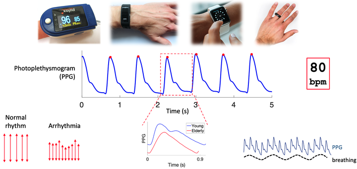 Smart watches could predict higher risk of heart failure •  healthcare-in-europe.com