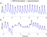 Detecting beats in the photoplethysmogram: benchmarking open-source algorithms