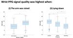 Determinants of photoplethysmography signal quality at the wrist