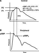 Relationship between fiducial points on the peripheral and central blood pressure waveforms: rate of rise of the central waveform is a determinant of peripheral systolic blood pressure