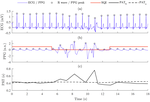 Influence of Photoplethysmogram Signal Quality on Pulse Arrival Time during Polysomnography