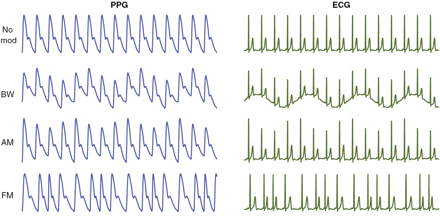 An assessment of algorithms to estimate respiratory rate from the ...